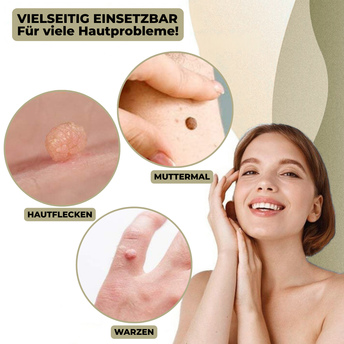 siopsrl | DermaLinx Wart Remover | Pain-Free Removal of Warts & Moles | For Home | Without Surgery