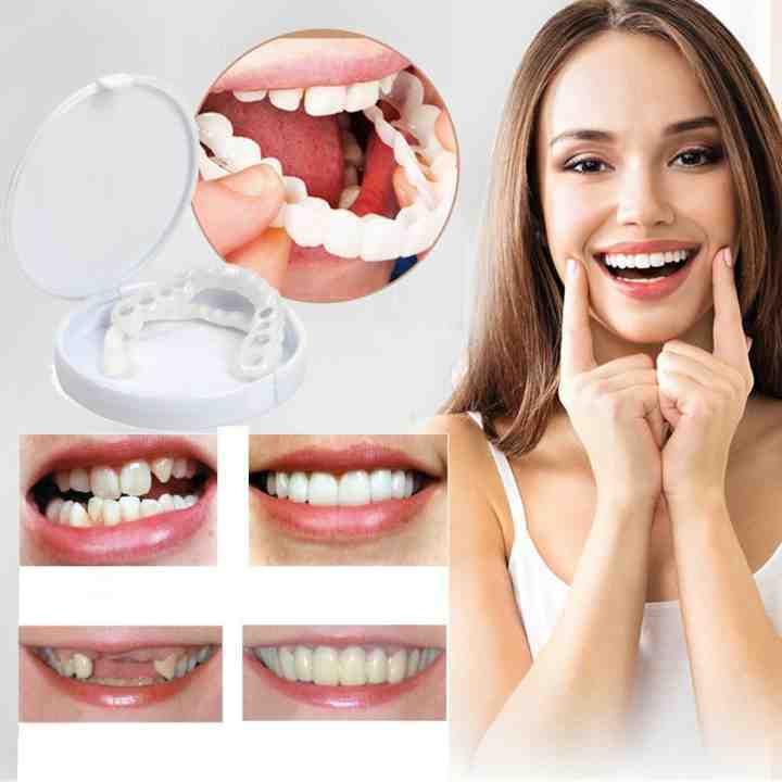 siopsrl | Snap-On Dentures