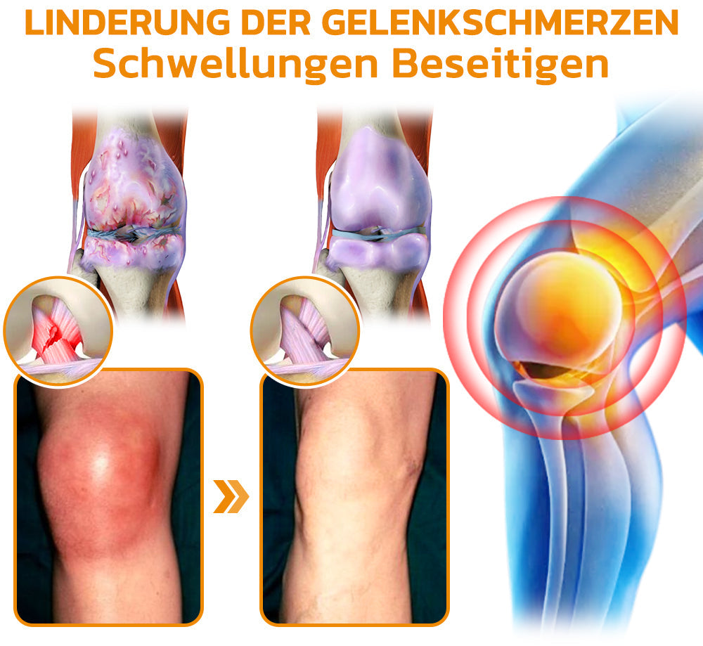 Bee Venom Joint Cream | siopsrl