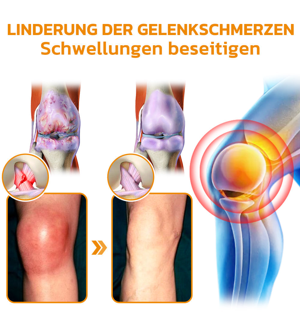 Bee Venom Joint Cream | siopsrl
