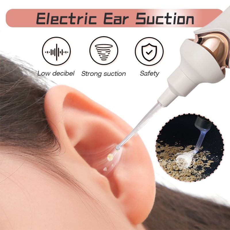 Siopsrl| Painless Ear Wax Removal Kit – Safe & Effective Cleaning for the Whole Family