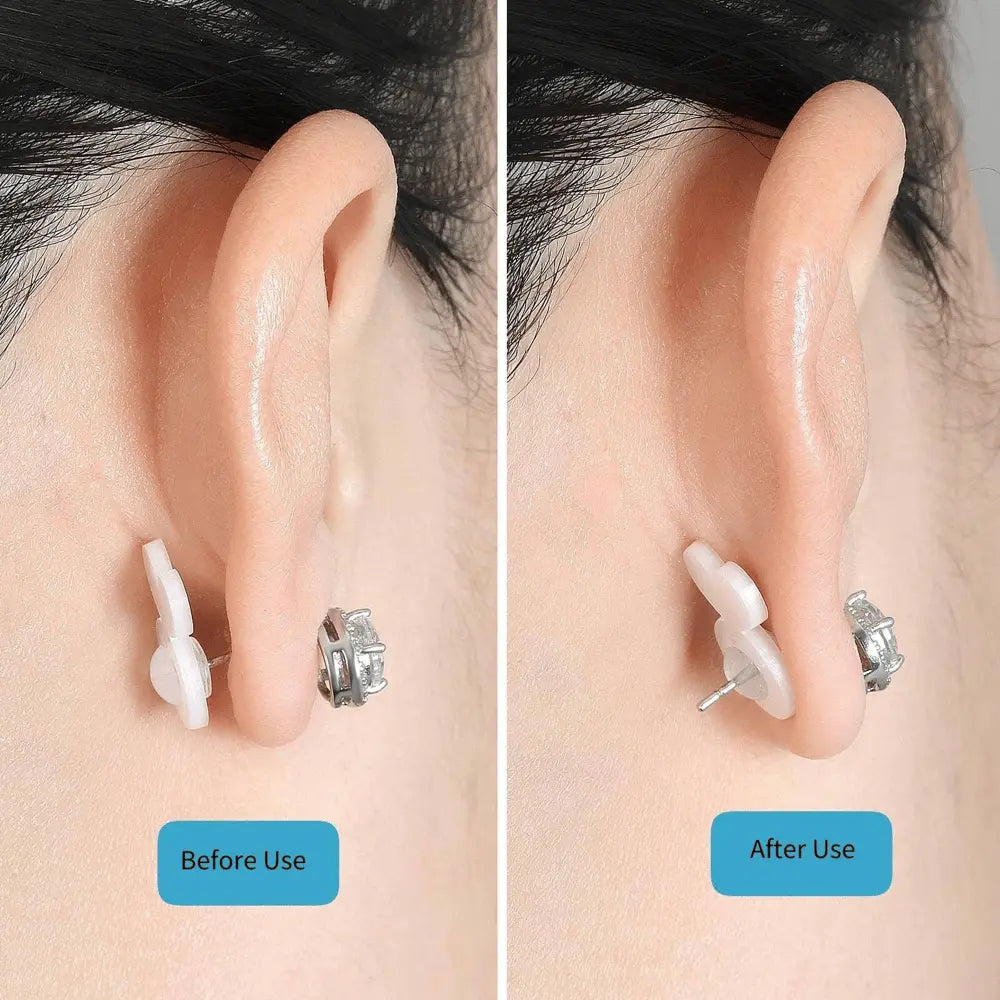 Siopsrl| Earring Stabilizer – For secure hold of heavy earrings without sagging